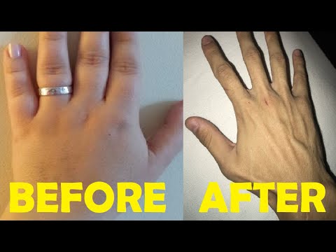 how to get rid of chubby hands