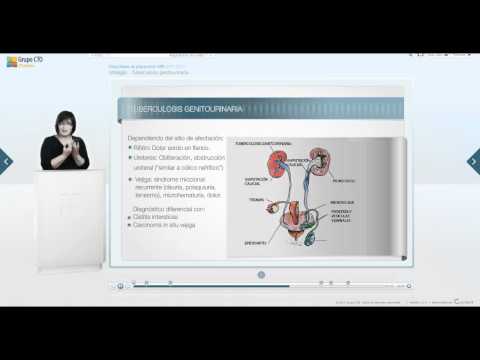 Mikrowellen-Behandlung von Prostatitis Symptome Behandlung von Prostatitis calculous