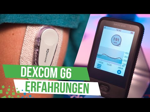 Das beste CGM-System? - Dexcom G6 (Review/Meine Erfahrungen)