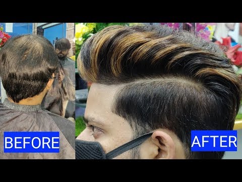 download lagu mp3 mp4 Non Surgical Hair Replacement In Delhi Price, download mp3 Non Surgical Hair Replacement In Delhi Price free download, download mp3 Non Surgical Hair Replacement In Delhi Price
