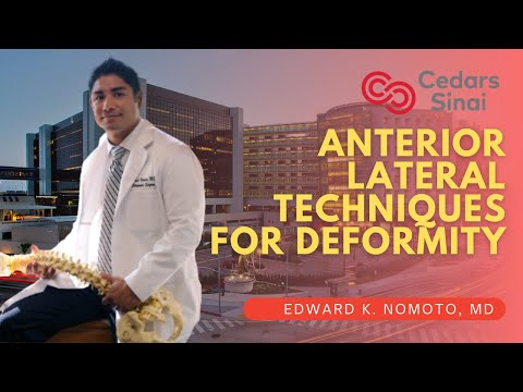 Anterior Lateral Techniques for Deformity - Edward K. Nomoto, M.D.