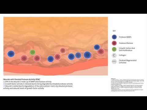 Systagenix Promogran Matrix Wound Dressing