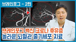 줄기세포 후기