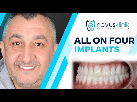 Logo of Affordable Dental Treatments in Istanbul, Turkey – Quality, Costs, and Real Patient Experiences