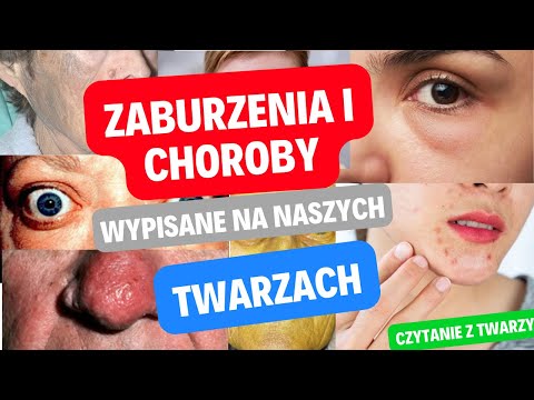 Zaburzenia i choroby wypisane na naszych twarzach. Czytanie z twarzy