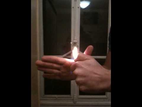 comment soigner brulure doigt