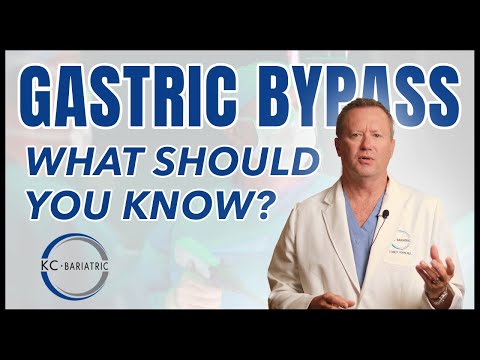 Gastric Bypass (RNY) - What Should You Know? | Bariatric FAQ Series