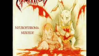 Mixomatosis - Neurofibroma Mixoide - FULL ALBUM
