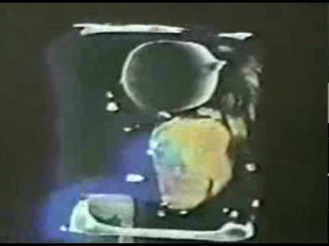 Peaking Lights - Tiger Eyes (Laid Back)