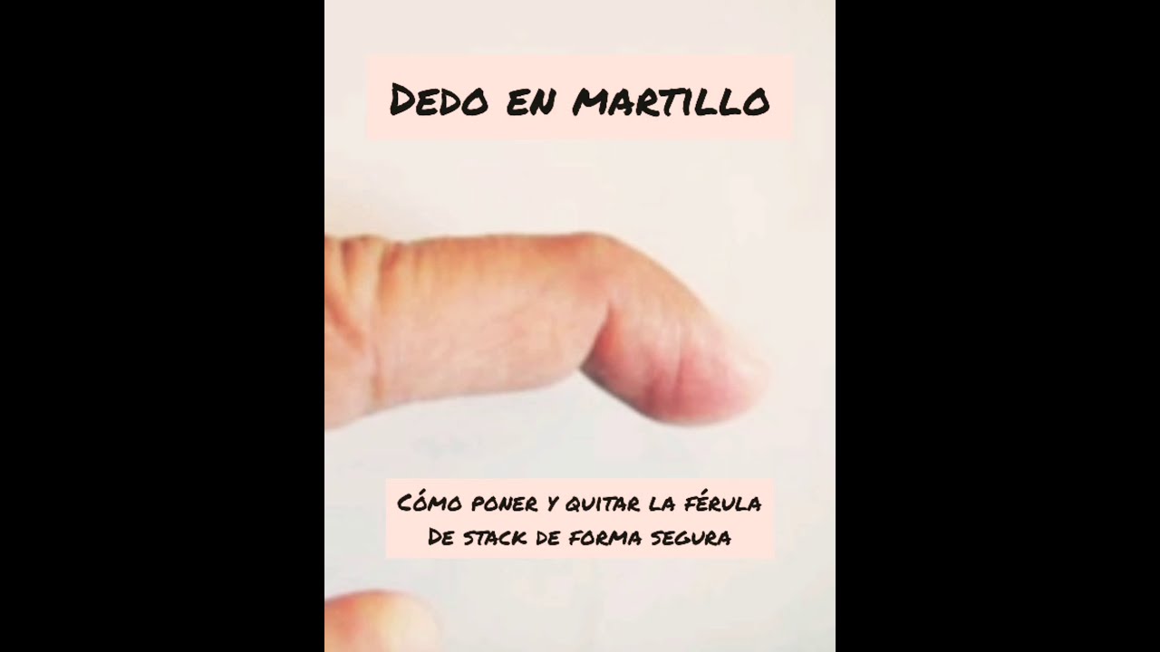 Cómo cambiar una férula de Stack de forma segura en el dedo en martillo