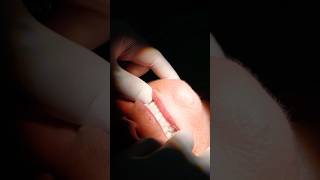 Download lagu Your smile is worth investing in. All on 4 Implants give you the smile you deserve. #dentalimplants mp3 Download lagu Your smile is worth investing in. All on 4 Implants give you the smile you deserve. #dentalimplants mp3