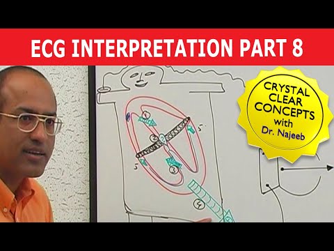 EKG or ECG Interpretation | Part 8/20