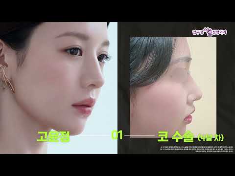 어 혹시 세경씨..? 추구미 연예인 사진 성형외과에 가져간 후기🧚‍♀️