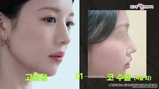 연예인 사진 성형외과에 가져간 후기