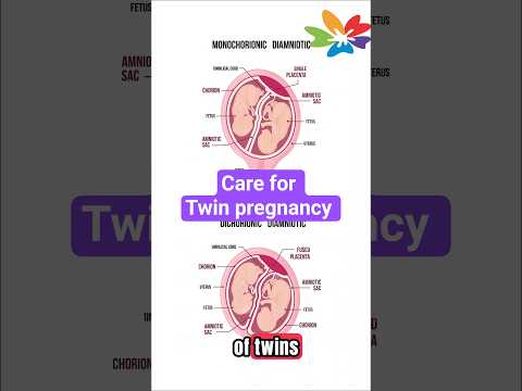 Twin pregnancy — what to do, important steps