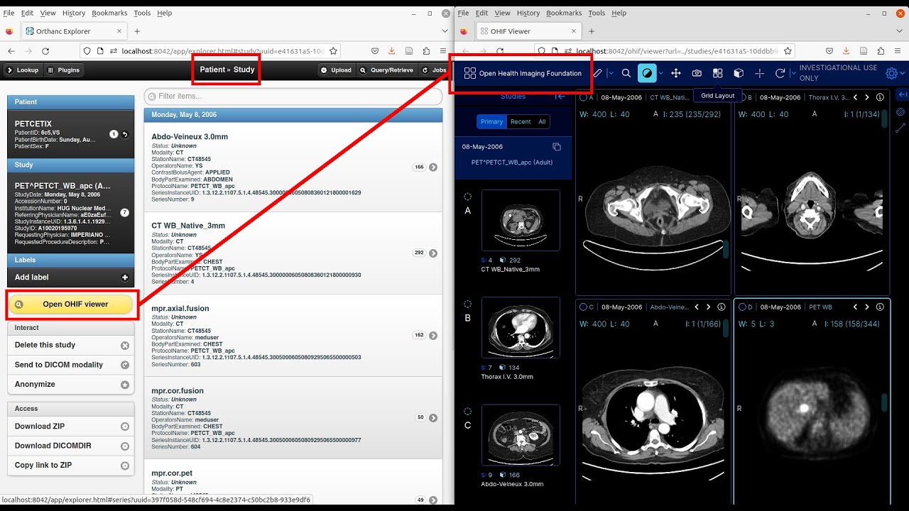 Orthanc plugin for OHIF