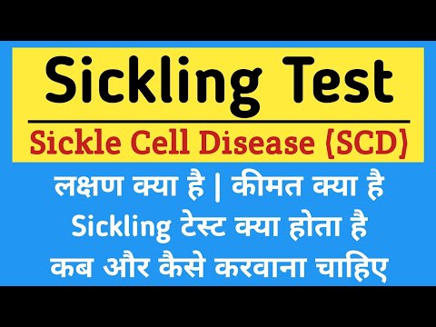 Sickling Test in hindi | Sickle cell Disease (SCD) in hindi | लक्षण, कीमत, कब और कैसे करवाना चाहिए