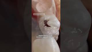 Download lagu Ini penyabab gigi geraham sering ngilu saat dibuat makan🎥cr : @vokaio mp3 Download lagu Ini penyabab gigi geraham sering ngilu saat dibuat makan🎥cr : @vokaio mp3
