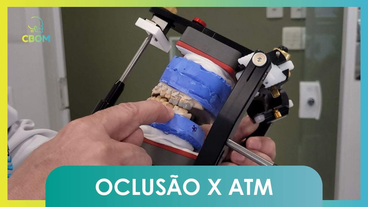 Oclusão x ATM