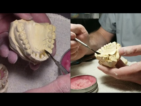 Live: Wire Wednesday #13 Part 1 - Reseting Upper and Lower teeth