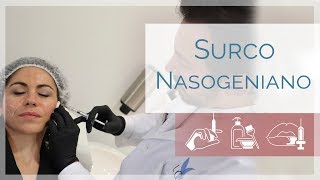 Elimina el SURCO NASOGENIANO | Dr. Miguel Lazo | Clínicas LeClinic's