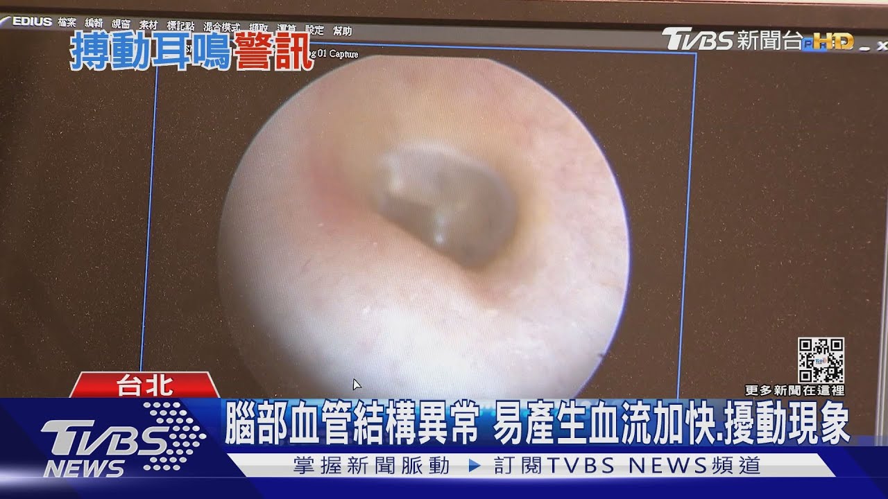 持續性聽到咻、咻、咻聲音　導致失眠注意！這疾病找上您