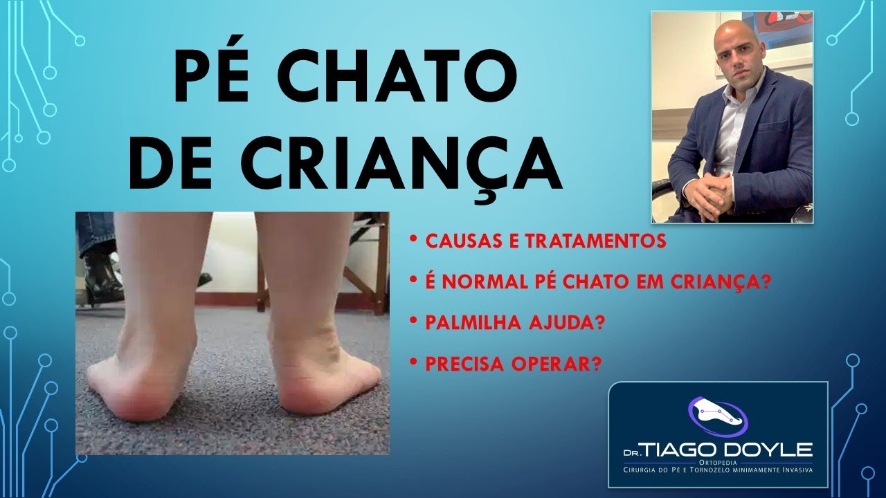 Pé chato infantil - como e quando tratar!!