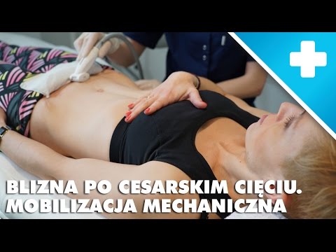 Objawy mięśniowe zastuzhena Tabletka do mięśnia