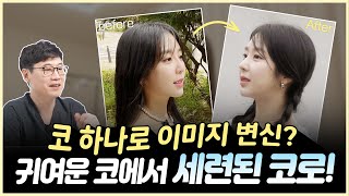 [휴먼성형외과] 달라진 예원 코! 이렇게 이미지 변신이 가능해?!