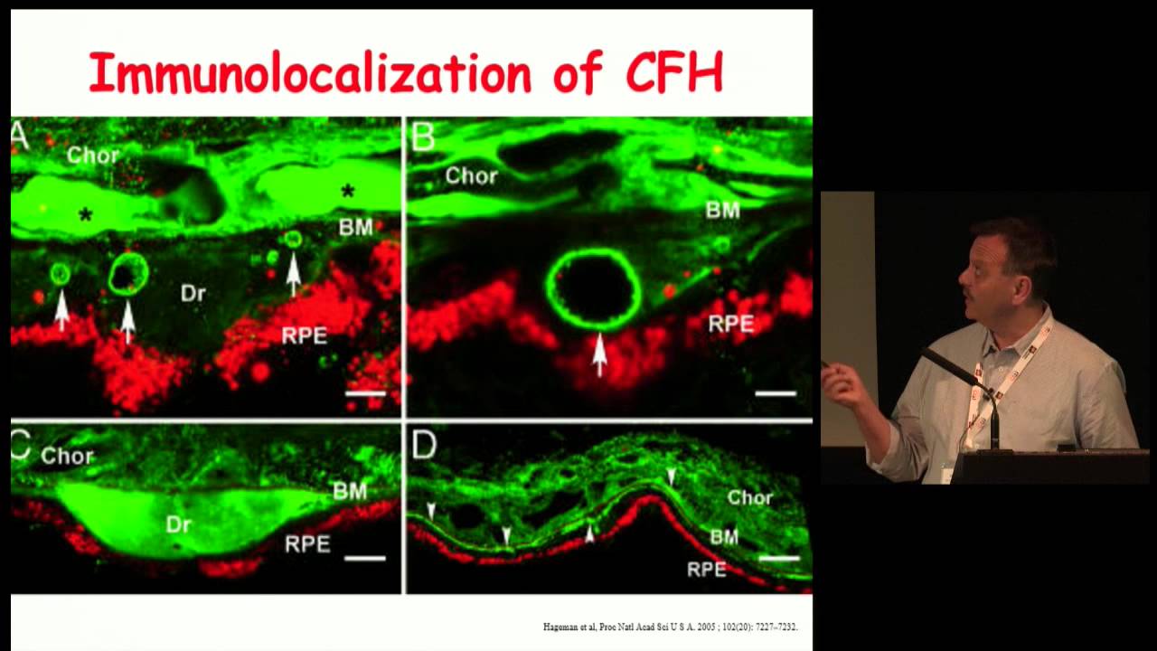 YouTube video thumbnail for: Lecture at Macular Carotenoids Conference