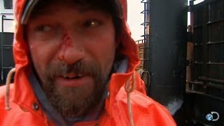 Captain Johnathan Hillstrand Breaks His Nose | Deadliest Catch