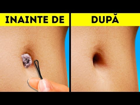 cum pierdeți greutatea la domiciliu vip pierdere în greutate boca