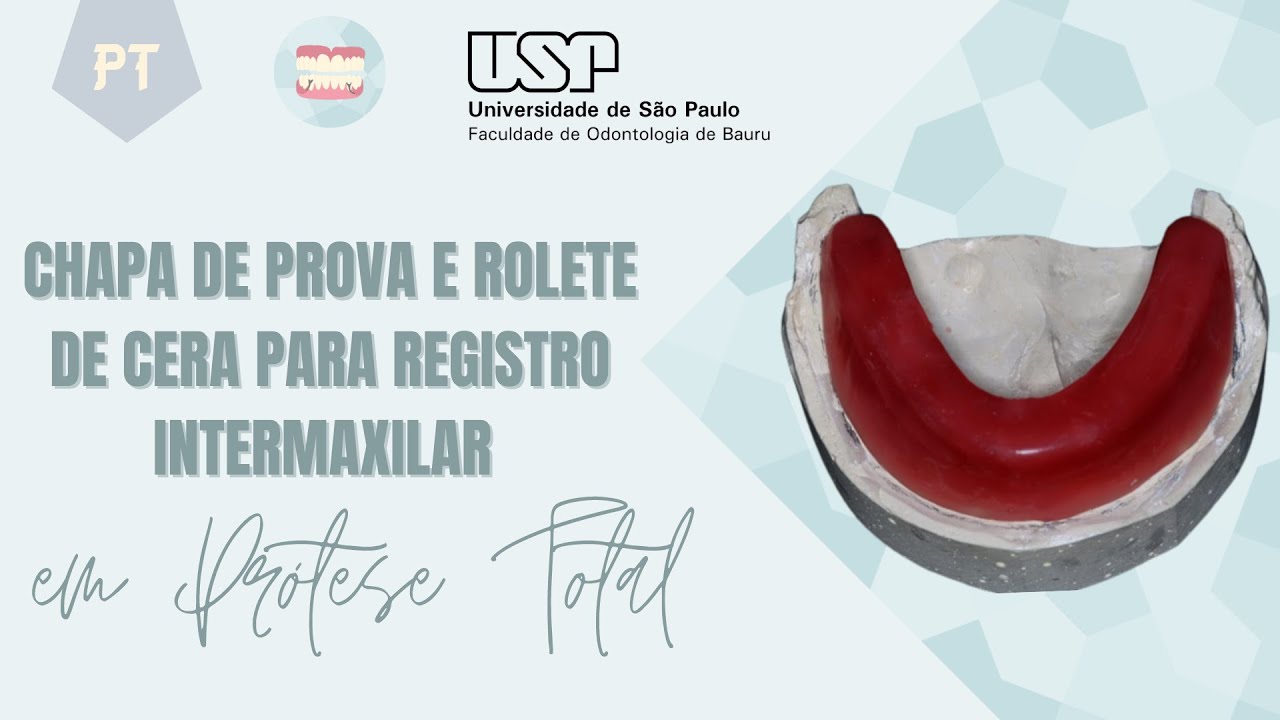 Chapa de prova e rolete de cera para registro intermaxilar em Prótese Total