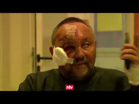 Angriff auf Magnitz: Ermittlungen wegen Körperverletzung