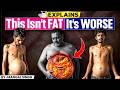 Why Do Indians Have Strange Belly Fat The Hidden Fat That S Killing Millions StudyIQ