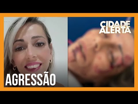 Mulher que luta contra o câncer foi espancada pelo ex-companheiro; ele também agrediu a mãe dela