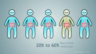 Nouveau traitement pour les infections a Clostridium Difficile