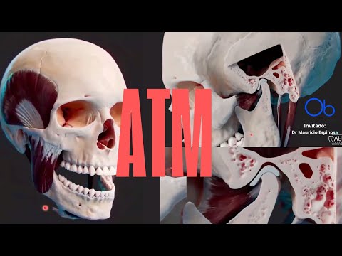 Articulación TemporoMandibular (ATM)