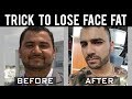Best Tips to LOSE FACE FAT! (Hindi / Punjabi)
