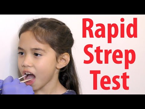 Rapid Strep Test: How Does it Work?