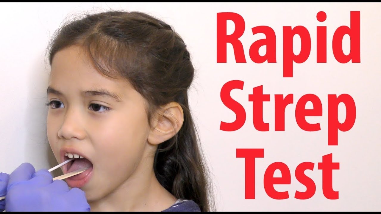 Rapid Strep Test: How Does it Work