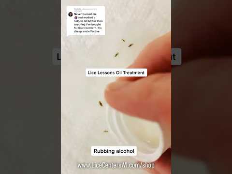 Is Rubbing Alcohol An Effective Head Lice Treatment? #licecenterswi #headlice