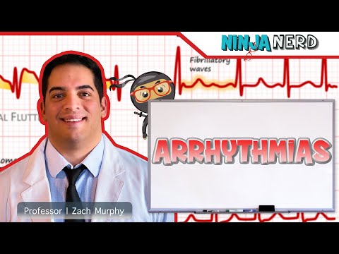 Arrhythmias | Clinical Medicine