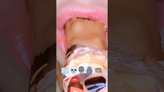 Download lagu ASMR Satisfying Eating Ice-cream Snicker Bar #asmr #icecream #satisfyinglips mp3