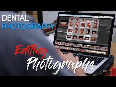 Dental Photography Basics - Editing Dental Photos