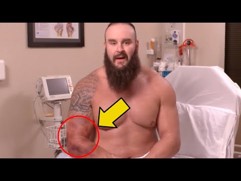 The Full Extent Of Braun Strowman's Injury Video