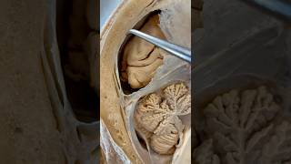 Incredible Tissue Surrounding Your Brain | Institute of Human Anatomy