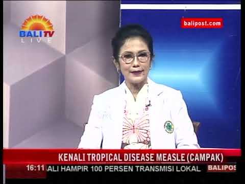 HARMONI BALI - KENALI TROPICAL DISEASE MEASLE (CAMPAK)