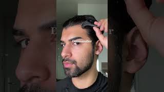 How to get a good HAIRLINE! #hairstyle #haircut #shorts