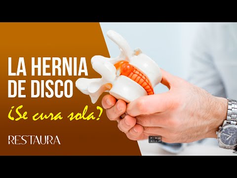 La hernia de disco ¿Se cura sola?